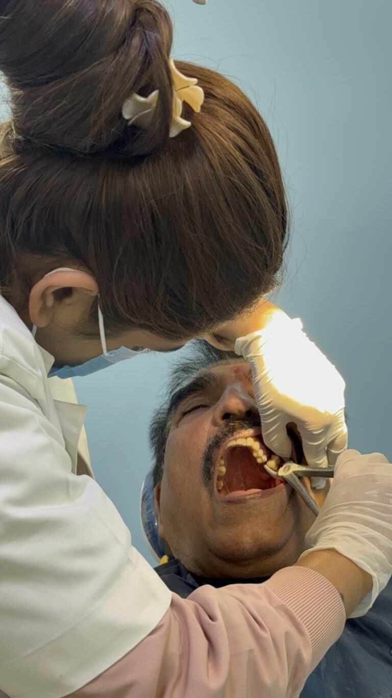 Wisdom Tooth Removal in Patna at Apollo Dental Care